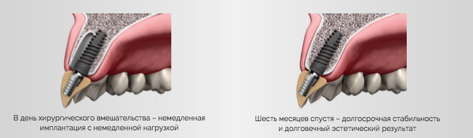 КЛИНИЧЕСКИЕ_ПРЕИМУЩЕСТВА_АЛЬФАБИО