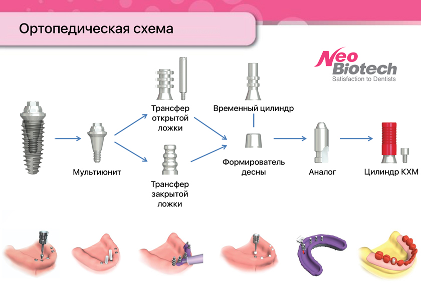 Ортопедическая схема мультиюнит NeoBiotech