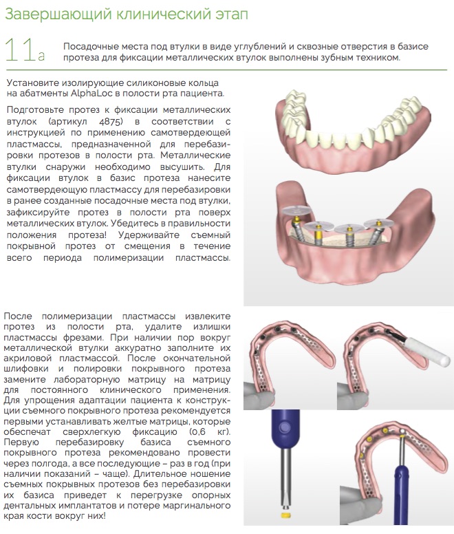 Протезирование_AlphaLoc_Ортопедический_протокол._Клинические_этапы_7.jpg