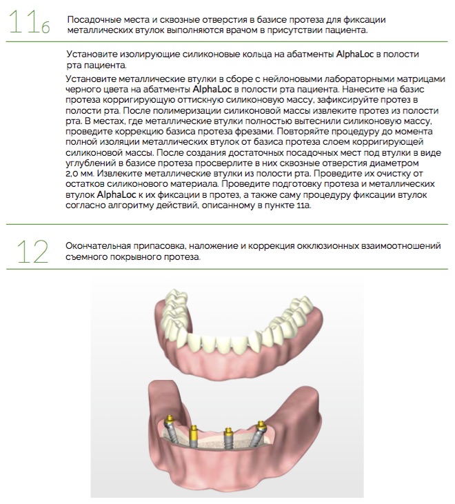 Протезирование_AlphaLoc_Ортопедический_протокол._Клинические_этапы_8.jpg