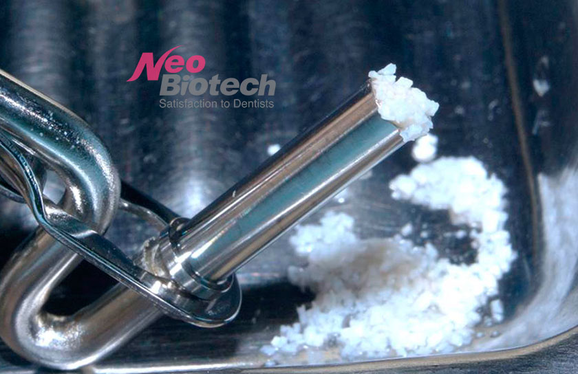 Bone_Carrier_NeoBiotech