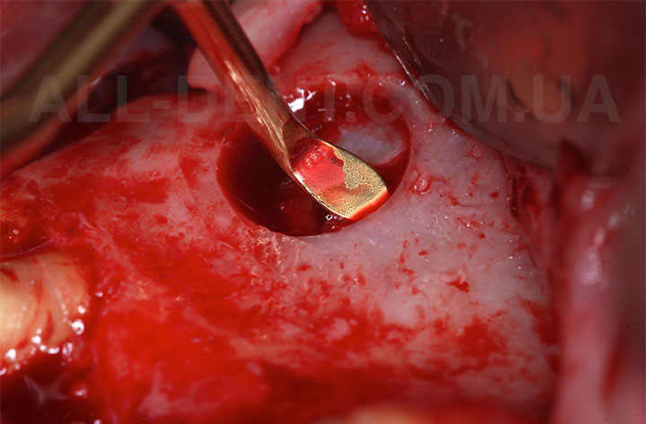 LS_риммер_NeoBiotech_3
