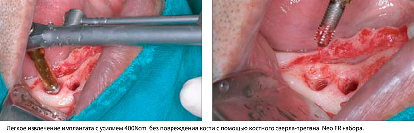 NeoBiotech-10.jpg