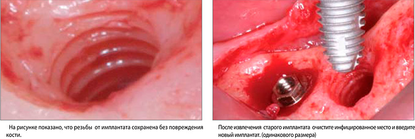 NeoBiotech-11.jpg