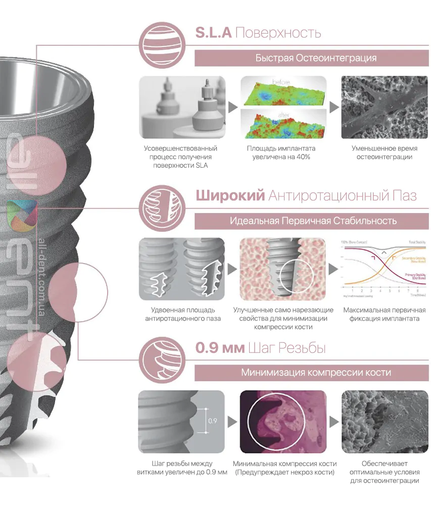 NeoBiotech IS-III Active имплантат | Описание и Характеристики