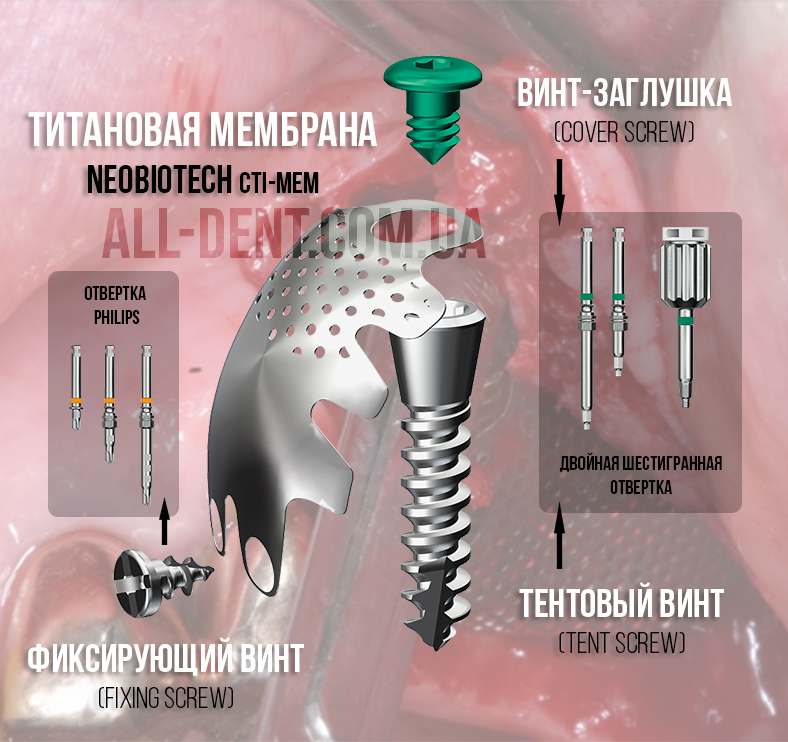 NeoBiotech_титановая_мембрана_all-dent.com.ua