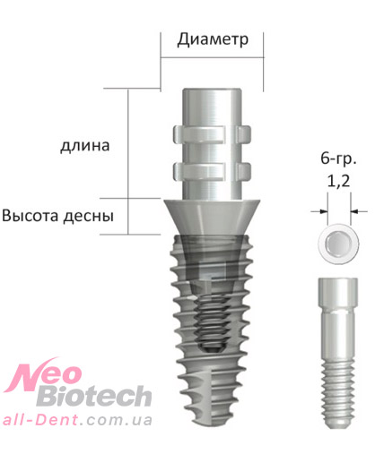 Абатмент_временный_Необиотек. Купить