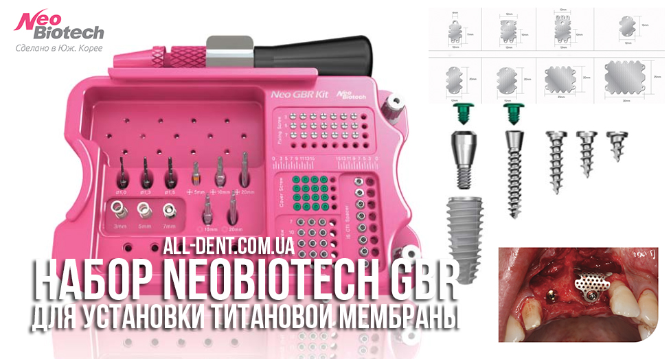 Набор_для_установки_титановой_мембраны_NeoBiotech