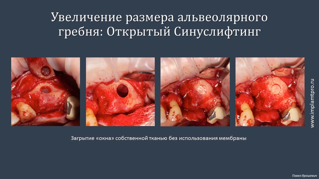 С-риммер_SLA_NeoBiotech_купить_в_киеве