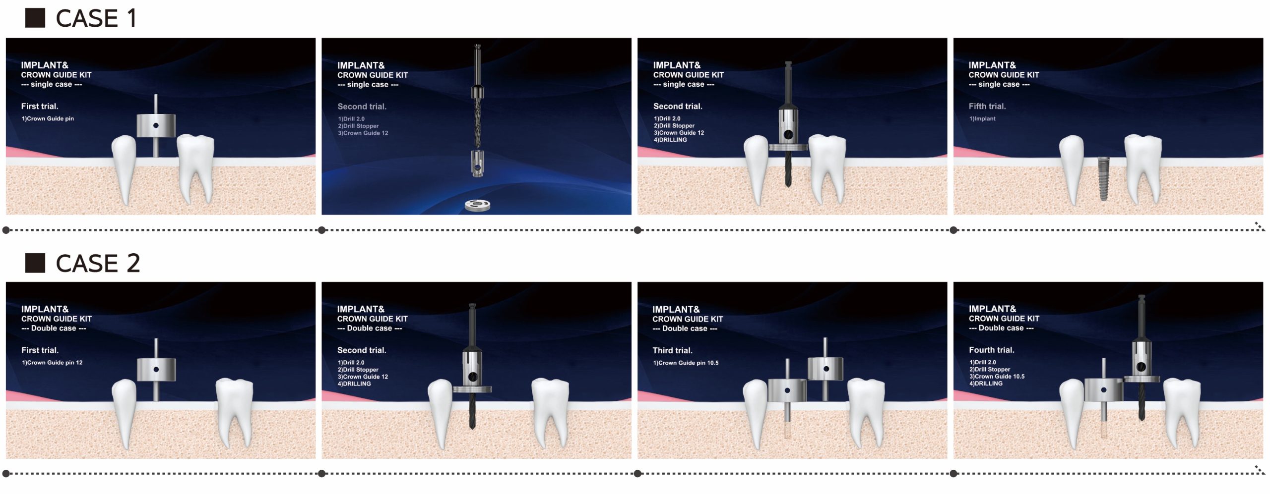 Техника применения. Набор для параллельной установки имплантов Dental Studio