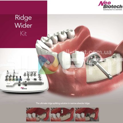 Набор для расщепления гребня | NeoBiotech Ridge Wider