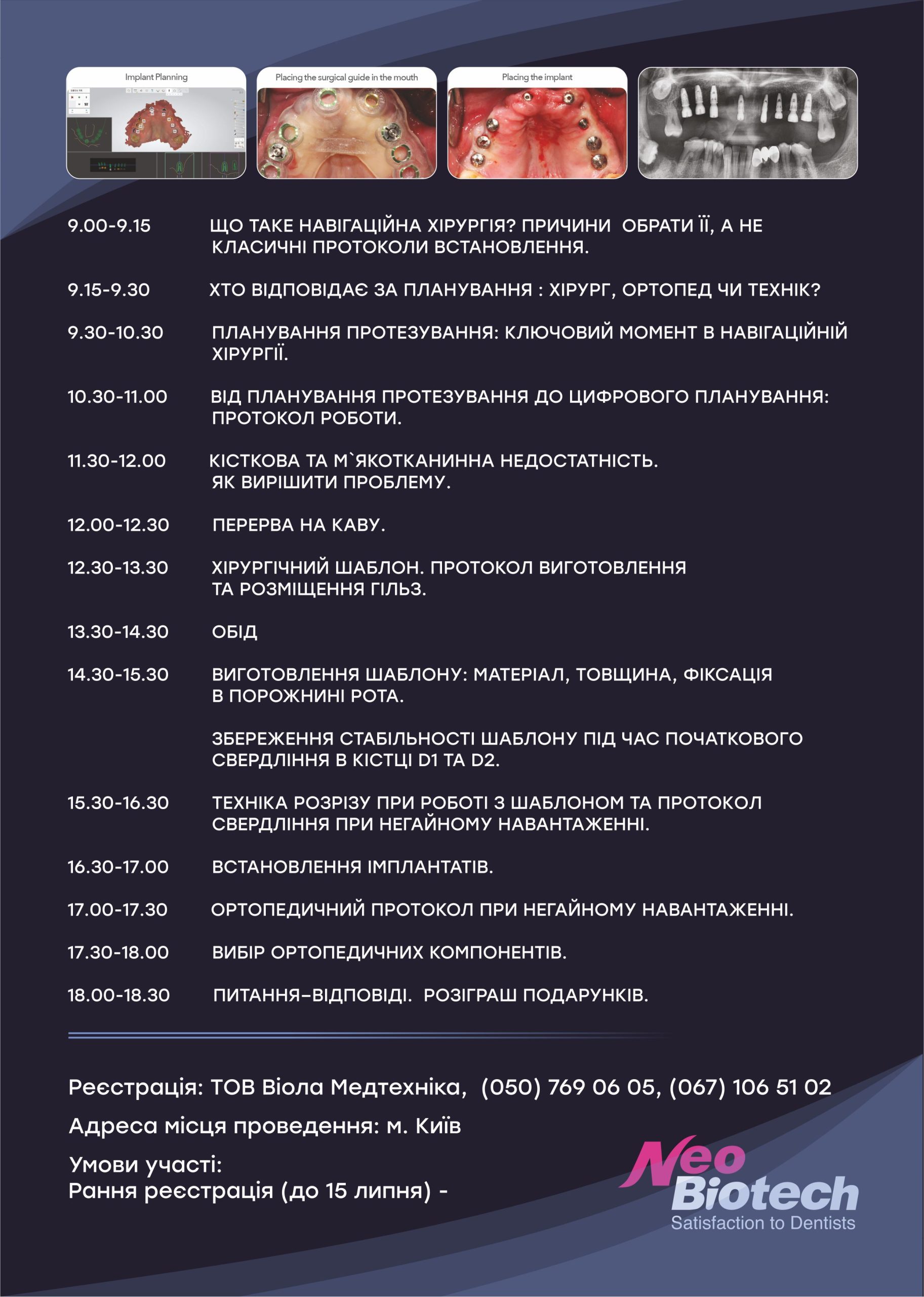 Навигационная хирургия в стоматологии